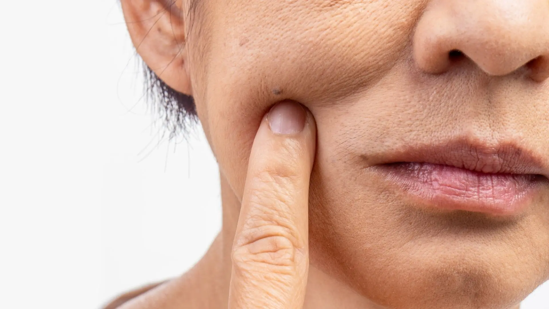 Bao Nhiêu Tuổi Vùng Má Bắt đầu Chảy Xệ Rõ Rệt
