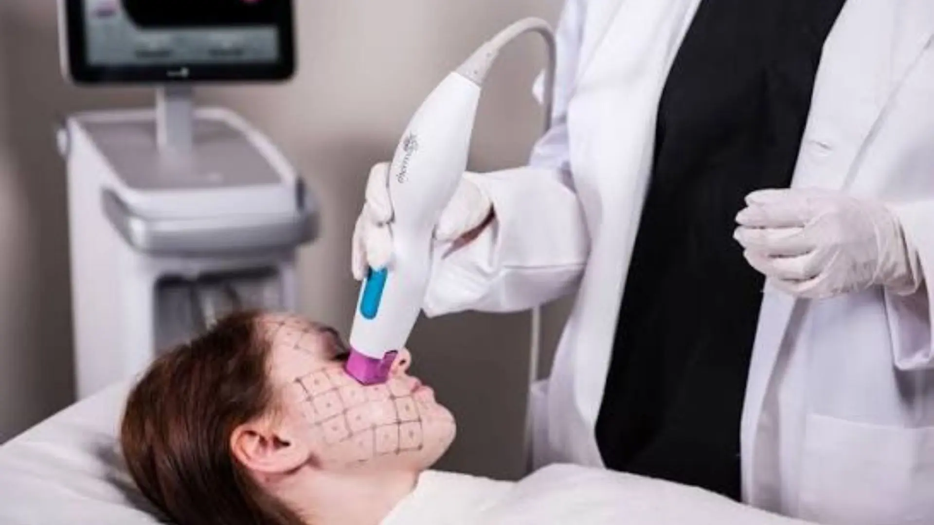Căng Da Công Nghệ Thermage FLX Không Phẫu Thuật Là Gì