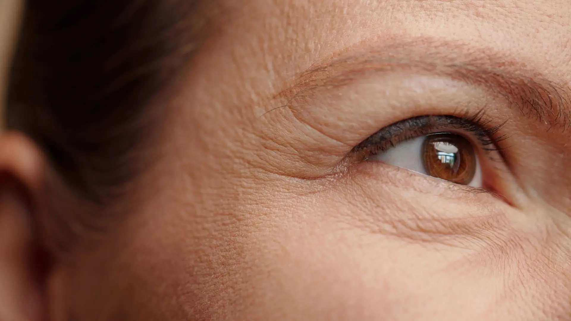 Căng Da Vùng Mắt Thermage FLX Có ảnh Hưởng Thị Lực Không
