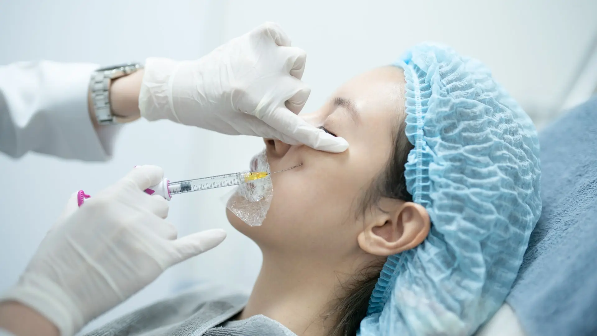 Giá Tiêm Filler Vùng Má Bao Nhiêu ở Bệnh Viện HCM