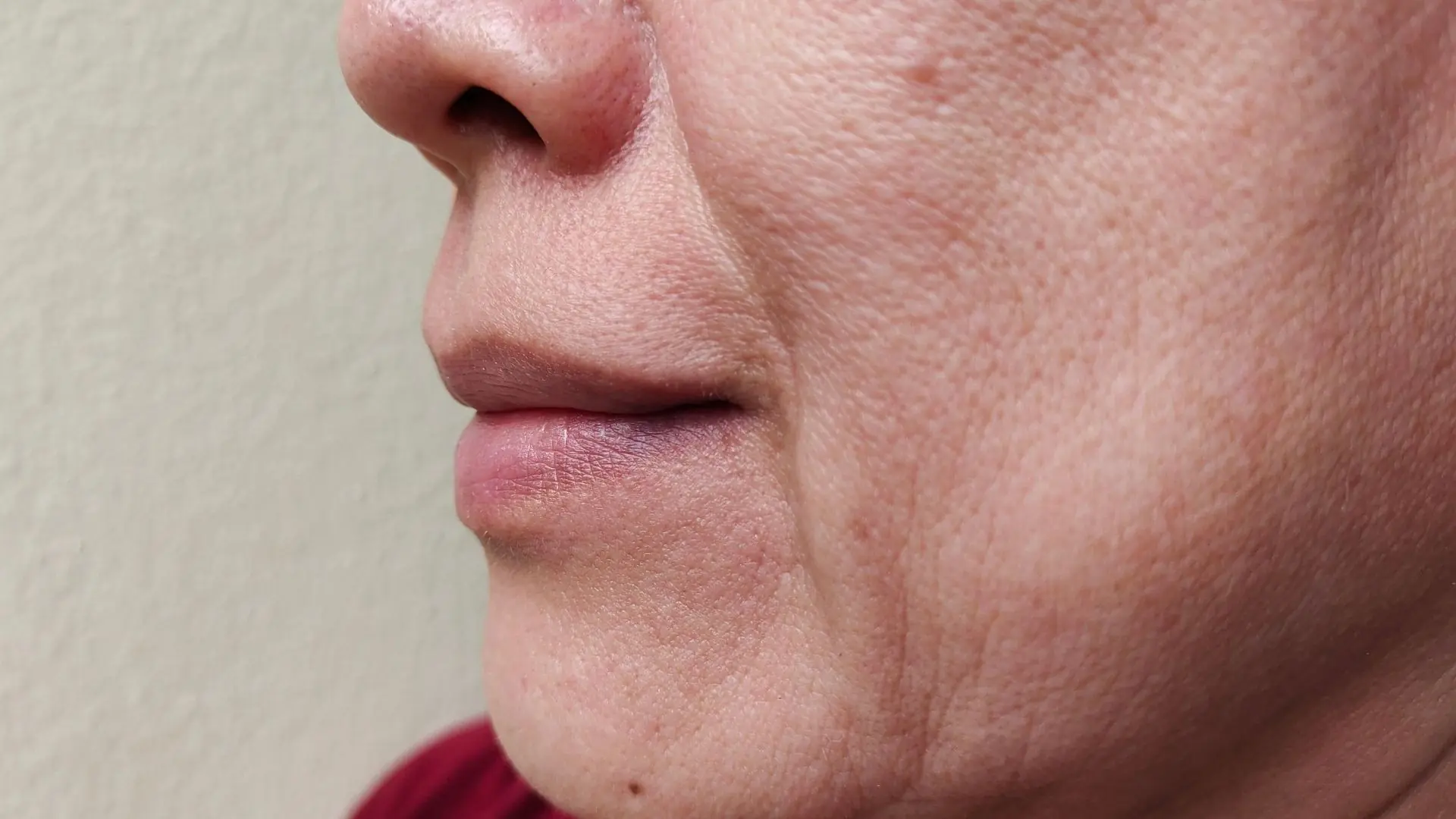 Lão Hóa ảnh Hưởng đến đường Viền Hàm Như Thế Nào