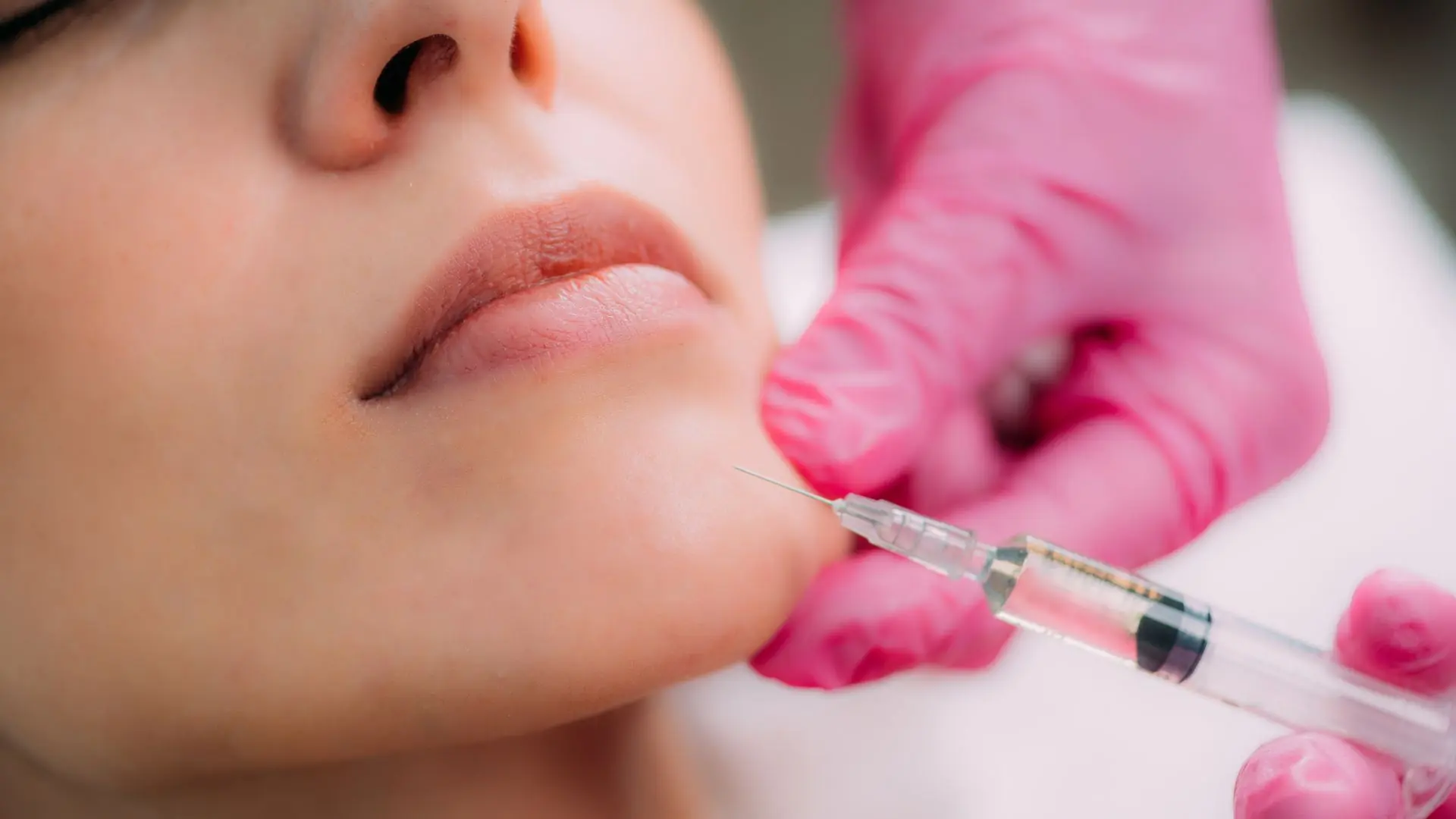 Tiêm Filler Cằm Có Nguy Hiểm Không