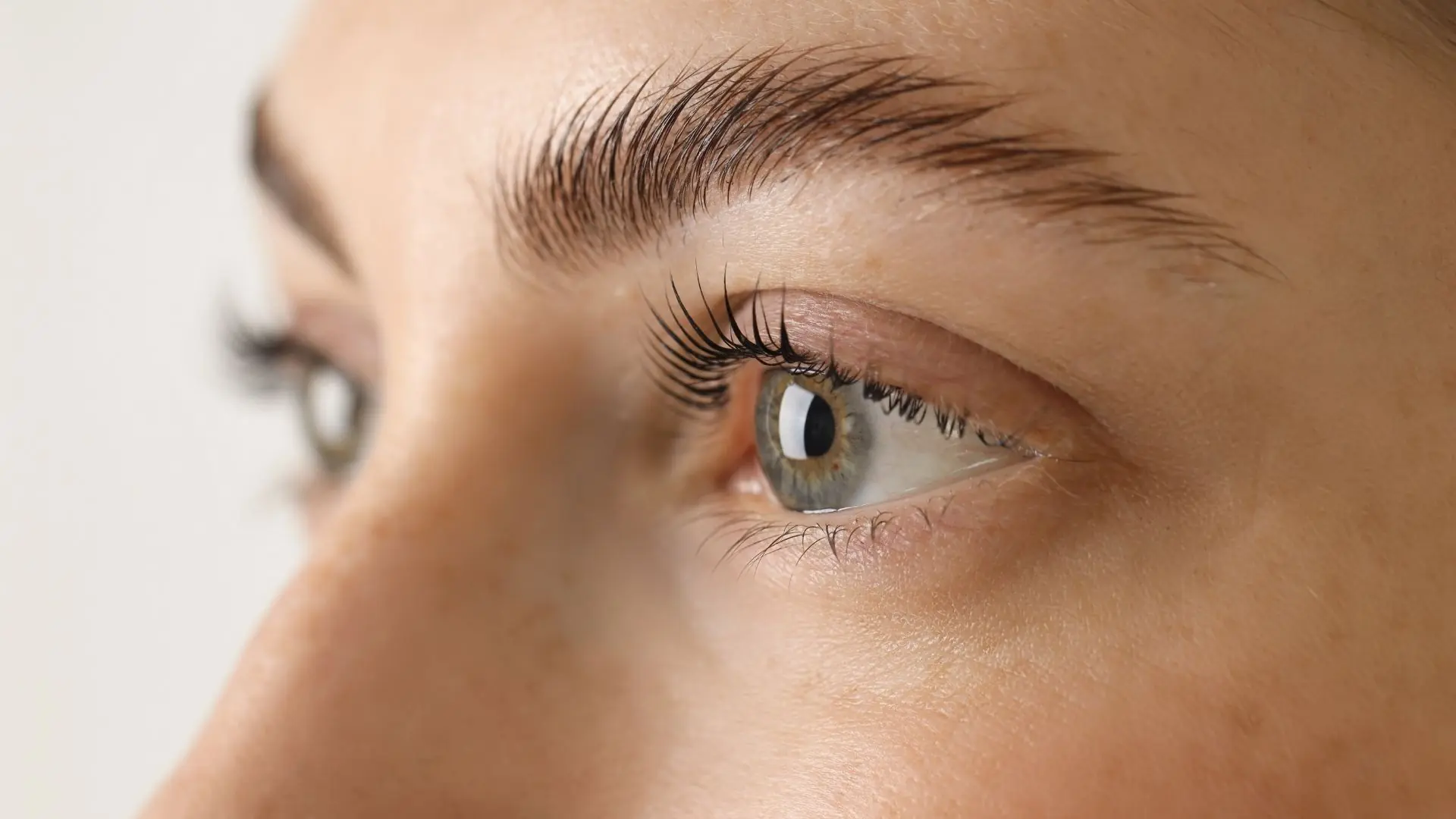 Ultherapy Prime Nâng Cơ, Trẻ Hóa Vùng Mắt Có Phù Hợp