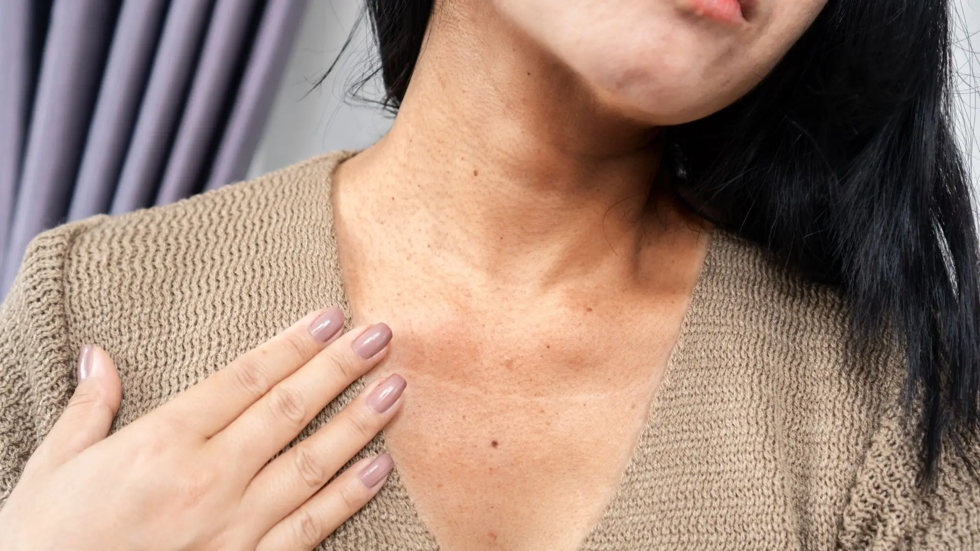 Vì Sao Da Vùng Cổ Mỏng Nên Dễ Xuất Hiện Nếp Nhăn