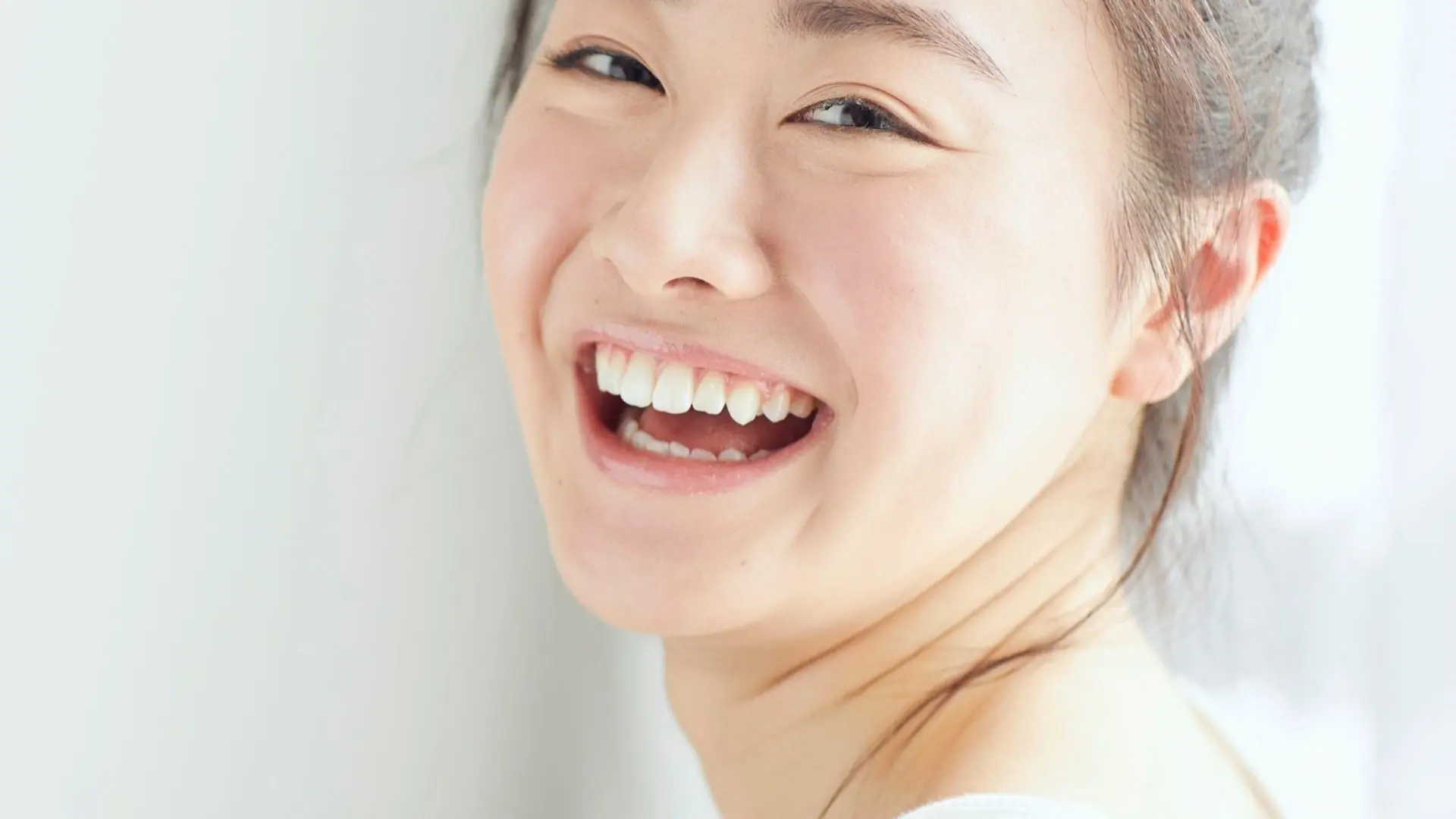 Vì Sao Hóp Má Thường đi Kèm Rãnh Cười Sâu