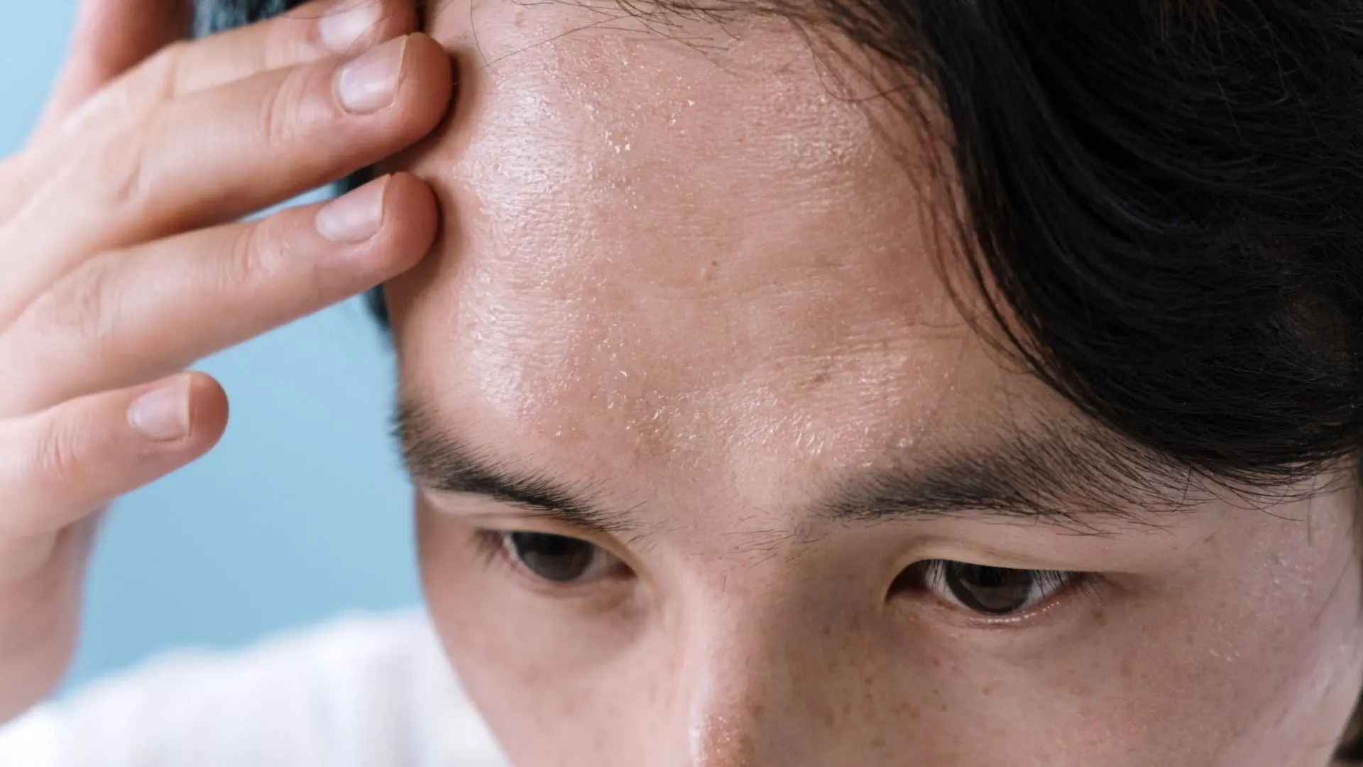 Vùng Trán Hóp Là Gì Đặc điểm, Thay đổi Và điều Cần Biết
